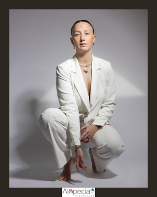alopecia-bold-social-media-visual 2