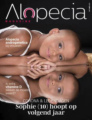 alopecia-magazine-oktober-2020-cover